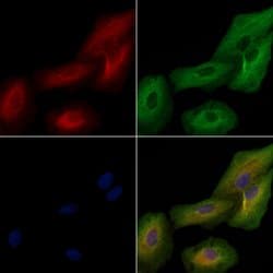 Invitrogen IL1F5 Polyclonal Antibody 100 &mu;L; Unconjugated:Antibodies,