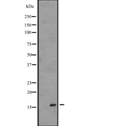 Invitrogen IL1F5 Polyclonal Antibody 100 &mu;L; Unconjugated:Antibodies,