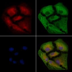 Invitrogen IL5RA (soluble) Polyclonal Antibody 100 &mu;L | Buy Online | Invitrogen&trade; | Fisher Scientific