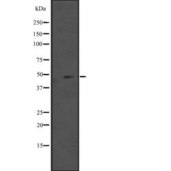 Invitrogen IL5RA (soluble) Polyclonal Antibody 100 &mu;L | Buy Online | Invitrogen&trade; | Fisher Scientific