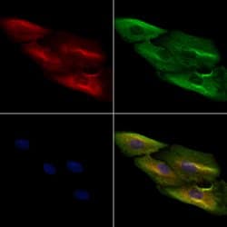 Invitrogen IL-9 Polyclonal Antibody 100 &mu;L; Unconjugated:Antibodies,