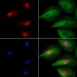 Invitrogen ING2 Polyclonal Antibody 100 &mu;L; Unconjugated:Antibodies,