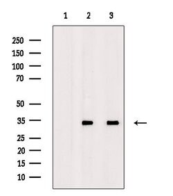 Invitrogen ING2 Polyclonal Antibody 100 &mu;L; Unconjugated:Antibodies,