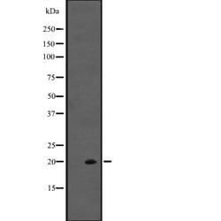 Invitrogen IL-20 Polyclonal Antibody 100 &mu;L; Unconjugated:Antibodies,
