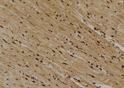 Invitrogen ITGA2 Polyclonal Antibody 100 &mu;L; Unconjugated:Antibodies,