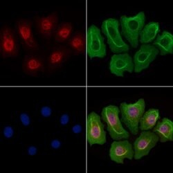 Invitrogen JMJD1B Polyclonal Antibody 100 &mu;L | Buy Online | Invitrogen&trade; | Fisher Scientific