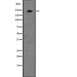 Invitrogen JMJD1B Polyclonal Antibody 100 &mu;L | Buy Online | Invitrogen&trade; | Fisher Scientific