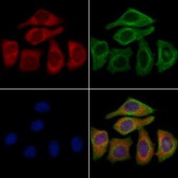 KCNN1 Polyclonal Antibody:Antibodies, Polyclonal