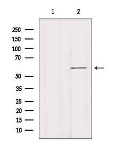 KCNN1 Polyclonal Antibody:Antibodies, Polyclonal