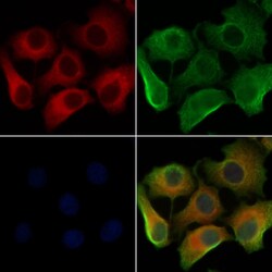 Invitrogen LAMTOR3 Polyclonal Antibody 100 &mu;L; Unconjugated:Antibodies,