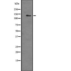 Invitrogen LPHN3 Polyclonal Antibody 100 &mu;L; Unconjugated:Antibodies,