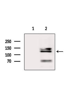 Invitrogen MSH3 Polyclonal Antibody 100 &mu;L; Unconjugated:Antibodies,