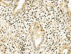 Invitrogen NFE2L1 Polyclonal Antibody 100 &mu;L; Unconjugated:Antibodies,