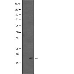 Invitrogen PDCD5 Polyclonal Antibody 100 &mu;L | Buy Online | Invitrogen&trade; | Fisher Scientific