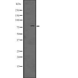 Invitrogen PKC eta Polyclonal Antibody 100 &mu;L; Unconjugated:Antibodies,