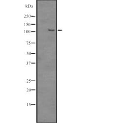 Invitrogen SRRM1 Polyclonal Antibody 100 &mu;L | Buy Online | Invitrogen&trade; | Fisher Scientific