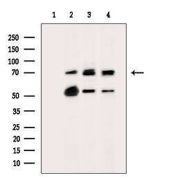 Invitrogen ST2 Polyclonal Antibody 100 &mu;L; Unconjugated:Antibodies,