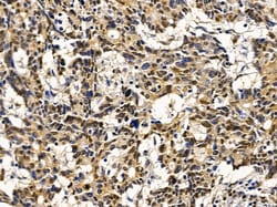 Invitrogen TAF7 Polyclonal Antibody 100 &mu;L | Buy Online | Invitrogen&trade; | Fisher Scientific