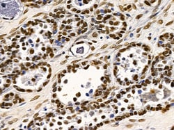 Invitrogen TAF7 Polyclonal Antibody 100 &mu;L | Buy Online | Invitrogen&trade; | Fisher Scientific