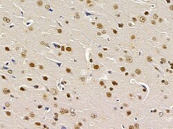 Invitrogen TAF7 Polyclonal Antibody 100 &mu;L | Buy Online | Invitrogen&trade; | Fisher Scientific