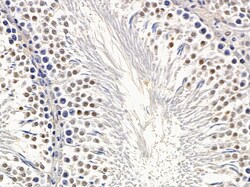 Invitrogen TAF7 Polyclonal Antibody 100 &mu;L | Buy Online | Invitrogen&trade; | Fisher Scientific