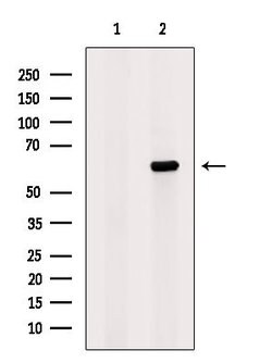 Invitrogen TAF7 Polyclonal Antibody 100 &mu;L | Buy Online | Invitrogen&trade; | Fisher Scientific