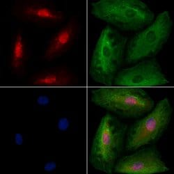 Invitrogen TBR1 Polyclonal Antibody 100 &mu;L; Unconjugated:Antibodies,