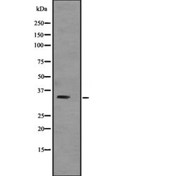 Invitrogen TNNT3 Polyclonal Antibody 100 &mu;L; Unconjugated:Antibodies,