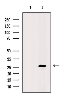 Invitrogen UBC3B Polyclonal Antibody 100 &mu;L; Unconjugated:Antibodies,