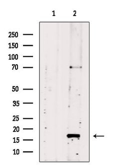 Invitrogen UBC3B Polyclonal Antibody 100 &mu;L; Unconjugated:Antibodies,