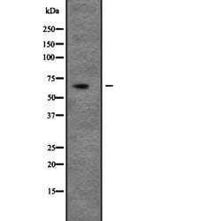 UNC5C Polyclonal Antibody, Invitrogen 100 &mu;L; Unconjugated:Antibodies,