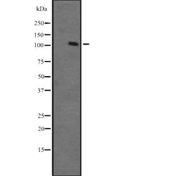 Invitrogen ZFPM1 Polyclonal Antibody 100 &mu;L; Unconjugated:Antibodies,