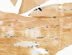 Invitrogen TAZ Polyclonal Antibody 100 &mu;L; Unconjugated:Antibodies,
