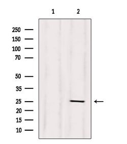 Invitrogen CD28 Polyclonal Antibody 100 &mu;L | Buy Online | Invitrogen&trade; | Fisher Scientific