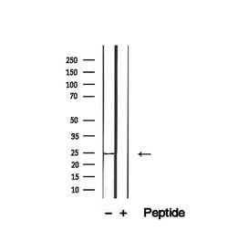 Invitrogen CD28 Polyclonal Antibody 100 &mu;L | Buy Online | Invitrogen&trade; | Fisher Scientific