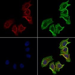 Invitrogen NCEH1 Polyclonal Antibody 100 &mu;L; Unconjugated:Antibodies,