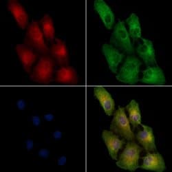 Invitrogen AASS Polyclonal Antibody 100 &mu;L; Unconjugated:Antibodies,