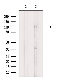 Invitrogen AASS Polyclonal Antibody 100 &mu;L; Unconjugated:Antibodies,
