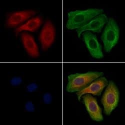 Invitrogen ABCB11 Polyclonal Antibody 100 &mu;L; Unconjugated:Antibodies,