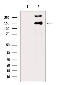Invitrogen ABCB11 Polyclonal Antibody 100 &mu;L; Unconjugated:Antibodies,