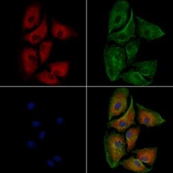 Invitrogen ABCB5 Polyclonal Antibody 100 &mu;L; Unconjugated:Antibodies,