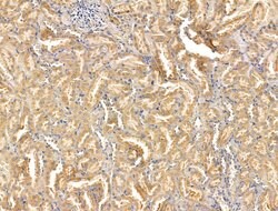Invitrogen ABCB5 Polyclonal Antibody 100 &mu;L; Unconjugated:Antibodies,