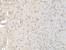 Invitrogen ABCB5 Polyclonal Antibody 100 &mu;L; Unconjugated:Antibodies,