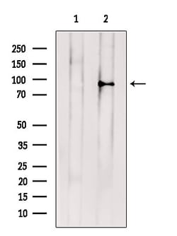 Invitrogen ABCB5 Polyclonal Antibody 100 &mu;L; Unconjugated:Antibodies,