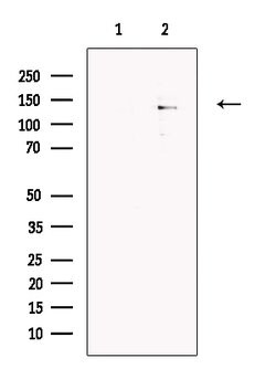 Invitrogen ABCB5 Polyclonal Antibody 100 &mu;L; Unconjugated:Antibodies,