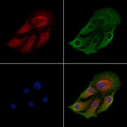 Invitrogen ACAA2 Polyclonal Antibody 100 &mu;L; Unconjugated:Antibodies,
