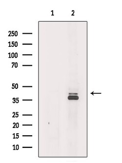 Invitrogen ACAA2 Polyclonal Antibody 100 &mu;L; Unconjugated:Antibodies,