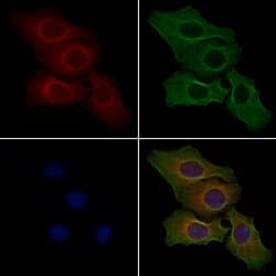 Invitrogen ACAP2 Polyclonal Antibody 100 &mu;L; Unconjugated:Antibodies,