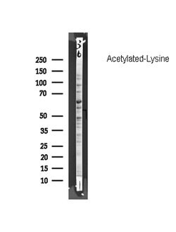 Invitrogen Acetylated Lysine Polyclonal Antibody 100 &mu;L; Unconjugated:Antibodies,