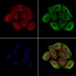 Invitrogen ASM Polyclonal Antibody 100 &mu;L; Unconjugated:Antibodies,